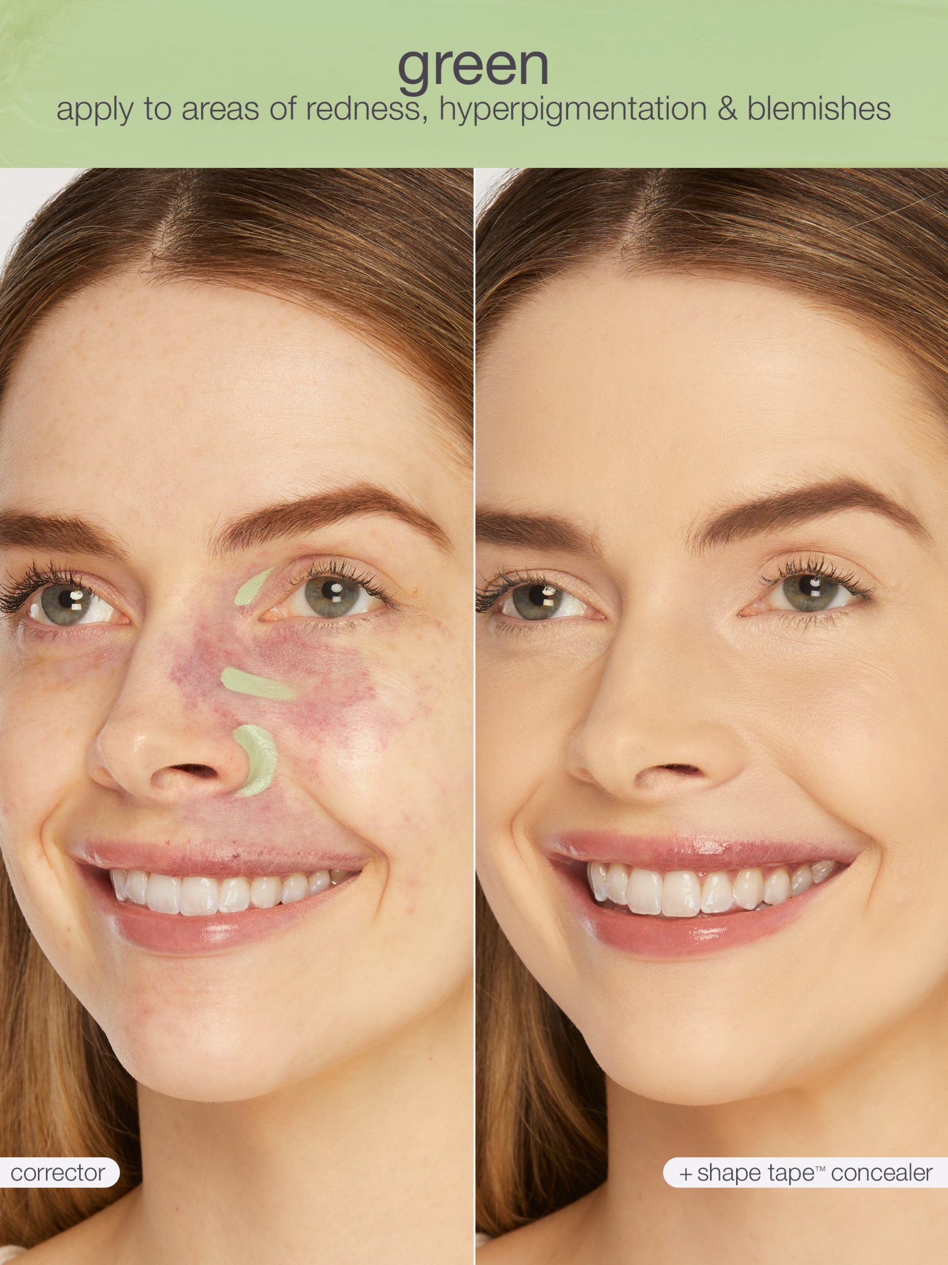unique__846733095513__shape-tape-corrector-green__02.jpg